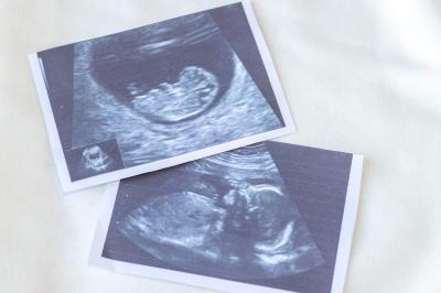 Abortion opponents take aim at surrogacy