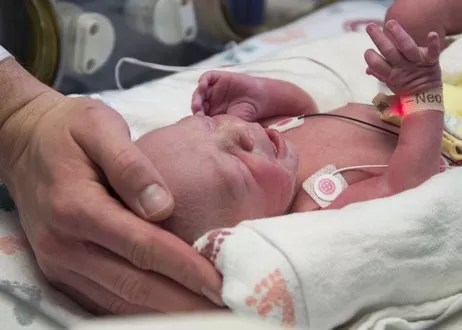 Birth of U.S. Baby After Uterine Transplant Shows Promise for the Future, Baylor Doctors Say