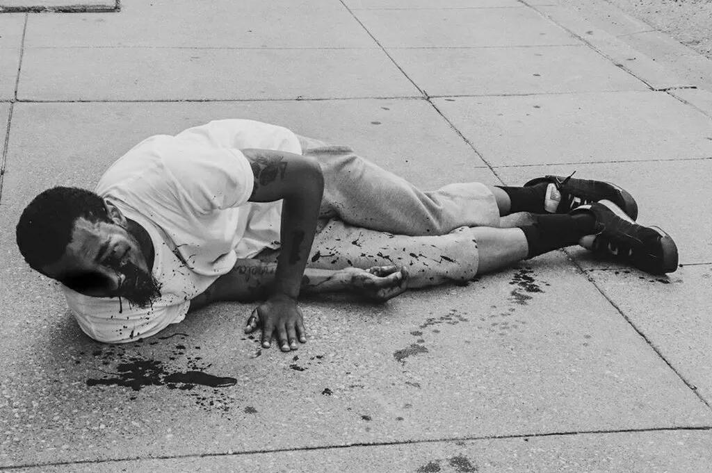 Brandon Saenz, Who Lost Eye in Peaceful Protest, Wants to Know Who Shot Him