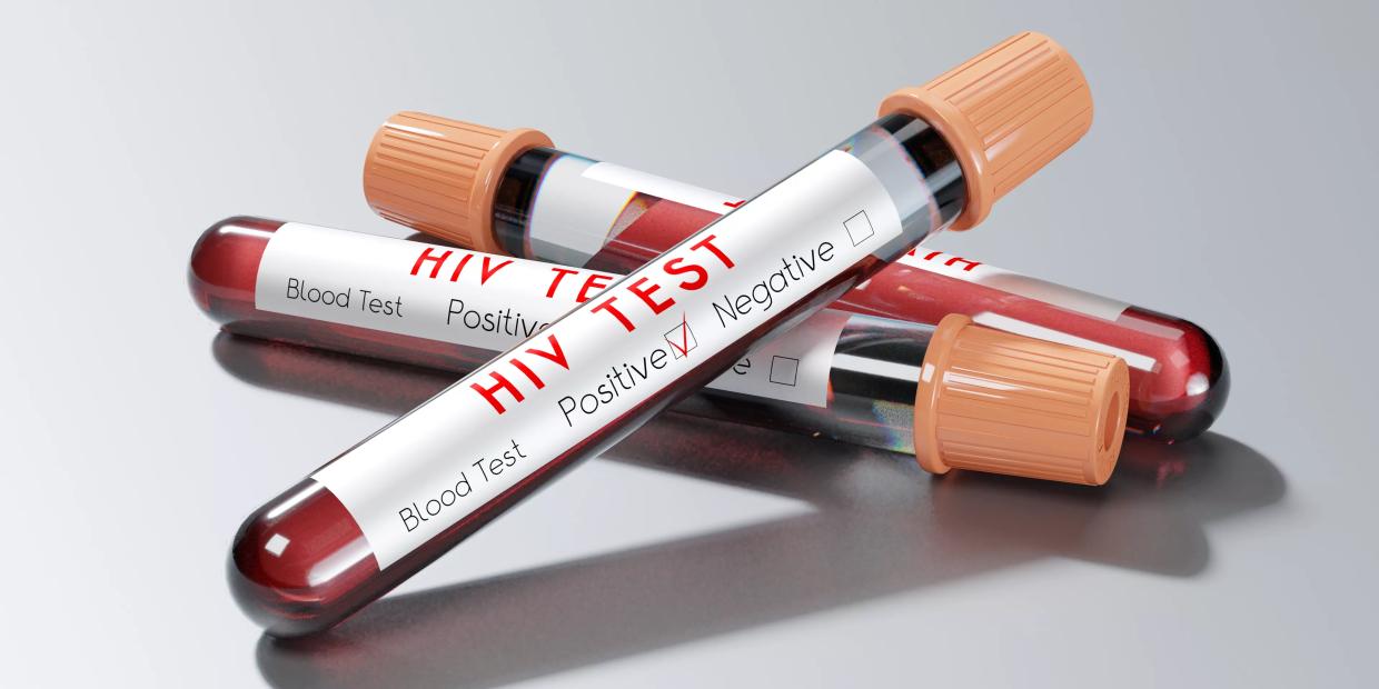 ‘A Wake Up Call’: HIV and STIs Cost Dallas County Nearly $400 Million